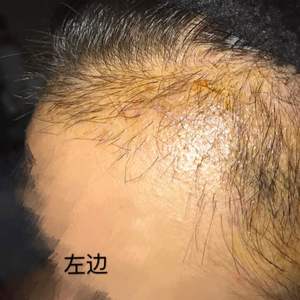 发际线分享社区