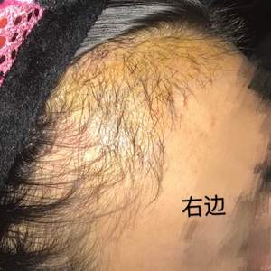 发际线分享社区
