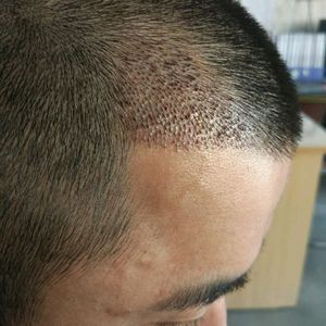 发际线分享社区