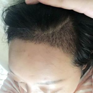 发际线分享社区