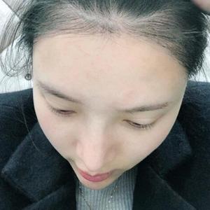 发际线分享社区
