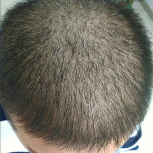 发际线分享社区