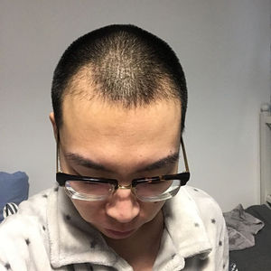 发际线分享社区