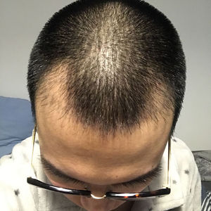 发际线分享社区