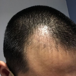 发际线分享社区