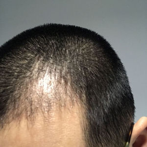 发际线分享社区