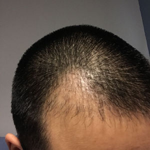 发际线分享社区