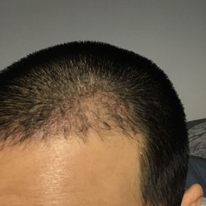 发际线分享社区