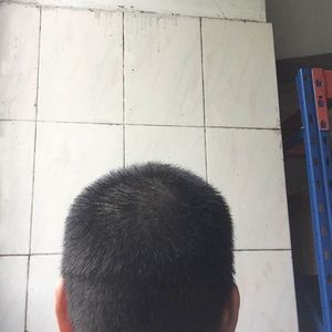 发际线分享社区