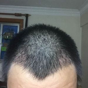 发际线分享社区