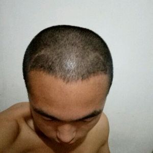 发际线分享社区