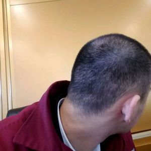 发际线分享社区