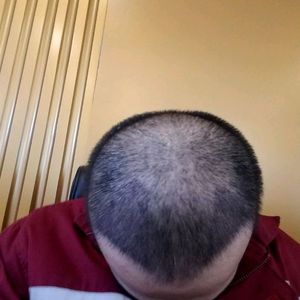 发际线分享社区