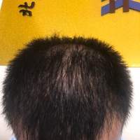 <font color="red">稀少加密</font>用戶圖片