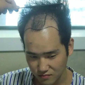 发际线分享社区