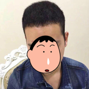 发际线分享社区