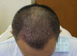 发际线分享社区