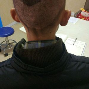发际线分享社区