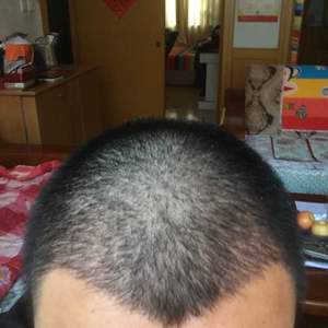 发际线分享社区
