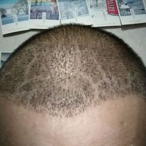发际线分享社区