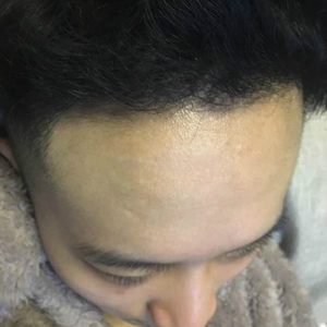 发际线分享社区