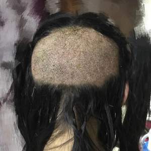 发际线分享社区
