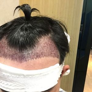 发际线分享社区