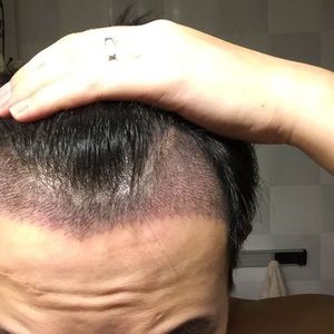 发际线分享社区