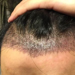 发际线分享社区