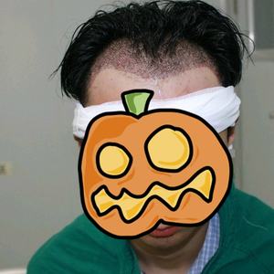 发际线分享社区