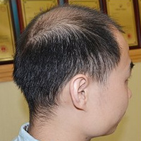<font color="red">稀少加密</font>用戶圖片
