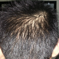 <font color="red">稀少加密</font>用戶圖片