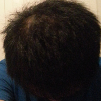 <font color="red">稀少加密</font>用戶圖片