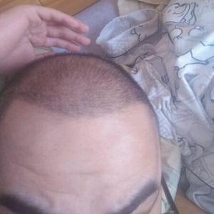 发际线分享社区