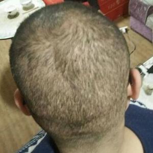 发际线分享社区