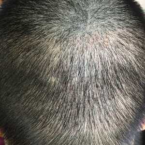 发际线分享社区