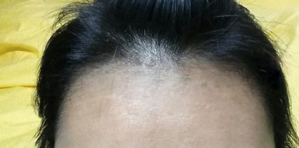 发际线分享社区