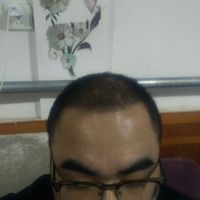 <font color="red">稀少加密</font>用戶圖片