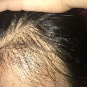 发际线分享社区