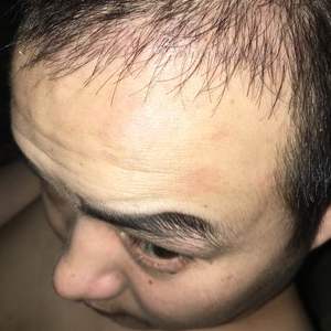 发际线分享社区