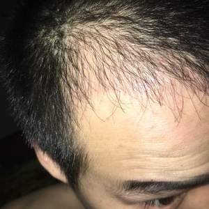 发际线分享社区