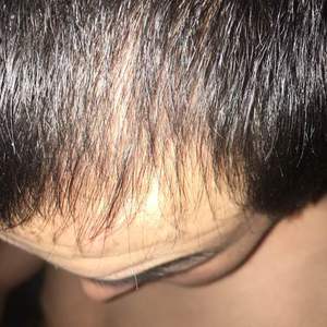 发际线分享社区