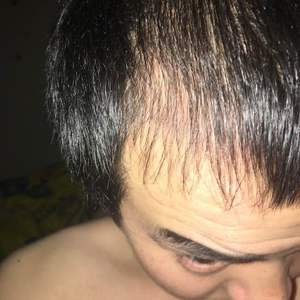 发际线分享社区