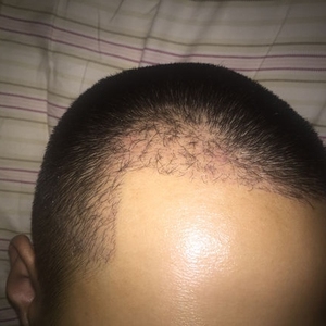 发际线分享社区