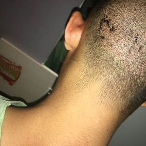 发际线分享社区