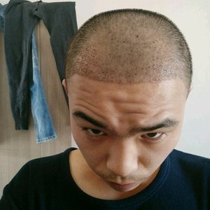 发际线分享社区