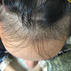 发际线分享社区