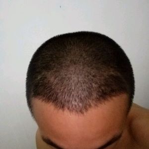 发际线分享社区