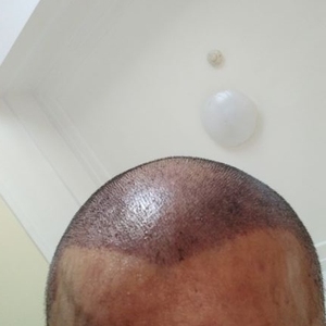 发际线分享社区