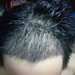 发际线分享社区